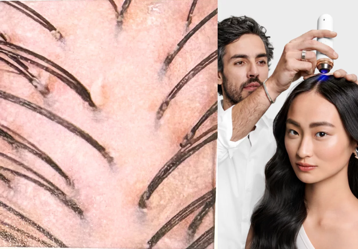 Discover Kérastase K-Scan, the smart AI-powered camera that delivers a personalized scalp and hair diagnosis for visibly healthier hair.